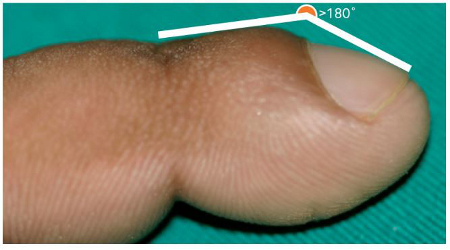 com.bmj.content.model.assessment.Caption@305f4491