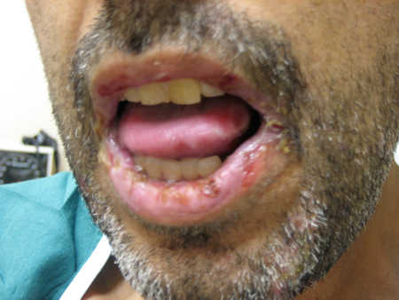 com.bmj.content.model.assessment.Caption@29172c3a